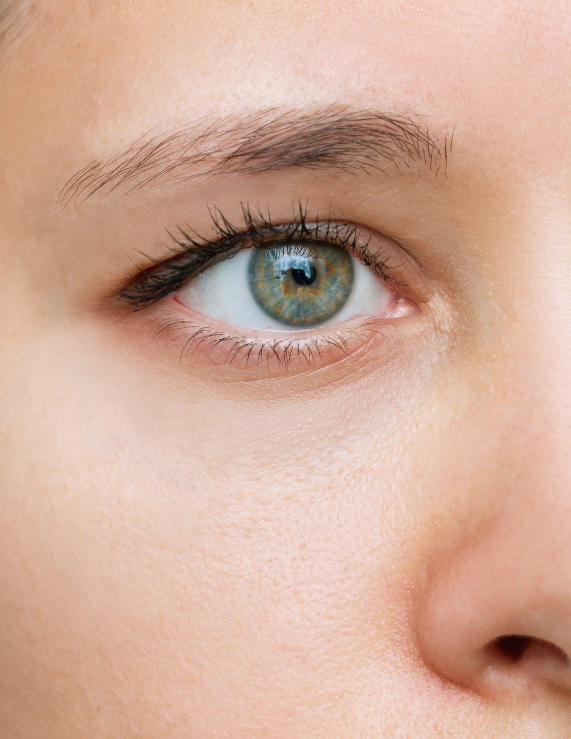 Eyelid Before Treatment